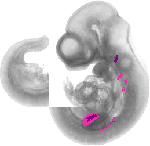 mouse atlas EMAGE spatial in situ gene expression database None