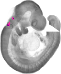 mouse atlas EMAGE spatial in situ gene expression database None