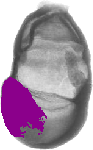 mouse atlas EMAGE spatial in situ gene expression database None