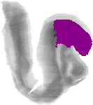 mouse atlas EMAGE spatial in situ gene expression database None