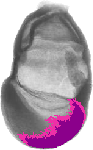 mouse atlas EMAGE spatial in situ gene expression database None