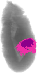 mouse atlas EMAGE spatial in situ gene expression database None