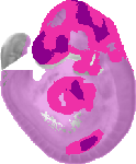 mouse atlas EMAGE spatial in situ gene expression database None