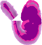 mouse atlas EMAGE spatial in situ gene expression database None