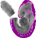 mouse atlas EMAGE spatial in situ gene expression database None