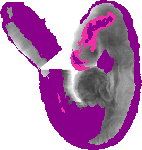 mouse atlas EMAGE spatial in situ gene expression database None