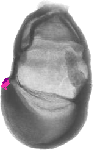 mouse atlas EMAGE spatial in situ gene expression database None
