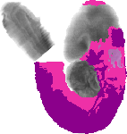 mouse atlas EMAGE spatial in situ gene expression database None