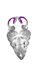 mouse atlas EMAGE spatial in situ gene expression database None