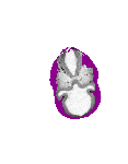 mouse atlas EMAGE spatial in situ gene expression database None