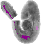 mouse atlas EMAGE spatial in situ gene expression database None