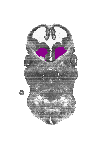 mouse atlas EMAGE spatial in situ gene expression database None