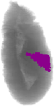 mouse atlas EMAGE spatial in situ gene expression database None