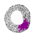 mouse atlas EMAGE spatial in situ gene expression database None