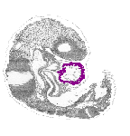 mouse atlas EMAGE spatial in situ gene expression database None