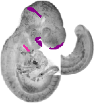 mouse atlas EMAGE spatial in situ gene expression database None