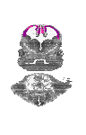 mouse atlas EMAGE spatial in situ gene expression database None