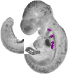 mouse atlas EMAGE spatial in situ gene expression database None