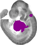 mouse atlas EMAGE spatial in situ gene expression database None