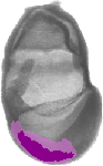 mouse atlas EMAGE spatial in situ gene expression database None