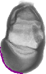 mouse atlas EMAGE spatial in situ gene expression database None