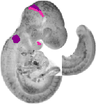 mouse atlas EMAGE spatial in situ gene expression database None