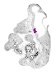 mouse atlas EMAGE spatial in situ gene expression database None