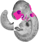 mouse atlas EMAGE spatial in situ gene expression database None