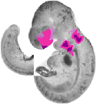 mouse atlas EMAGE spatial in situ gene expression database None