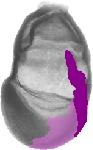 mouse atlas EMAGE spatial in situ gene expression database None
