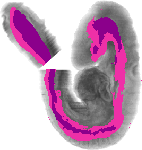 mouse atlas EMAGE spatial in situ gene expression database None