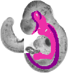 mouse atlas EMAGE spatial in situ gene expression database None