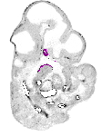 mouse atlas EMAGE spatial in situ gene expression database None