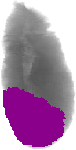 mouse atlas EMAGE spatial in situ gene expression database None