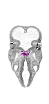 mouse atlas EMAGE spatial in situ gene expression database None