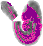 mouse atlas EMAGE spatial in situ gene expression database None
