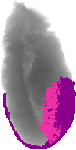 mouse atlas EMAGE spatial in situ gene expression database None