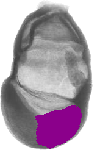 mouse atlas EMAGE spatial in situ gene expression database None