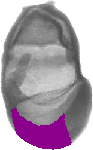 mouse atlas EMAGE spatial in situ gene expression database None