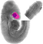 mouse atlas EMAGE spatial in situ gene expression database None
