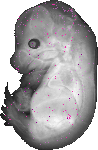mouse atlas EMAGE spatial in situ gene expression database None