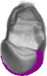mouse atlas EMAGE spatial in situ gene expression database None