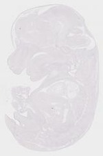 EMAGE:10408