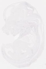 EMAGE:10472