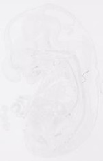 EMAGE:10578