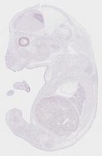 EMAGE:10708