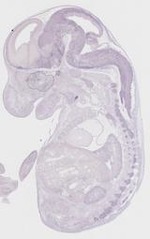 EMAGE:11008