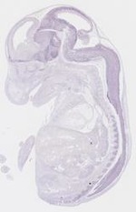 EMAGE:11008