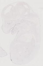 EMAGE:11034