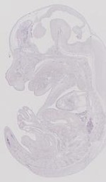 EMAGE:11090